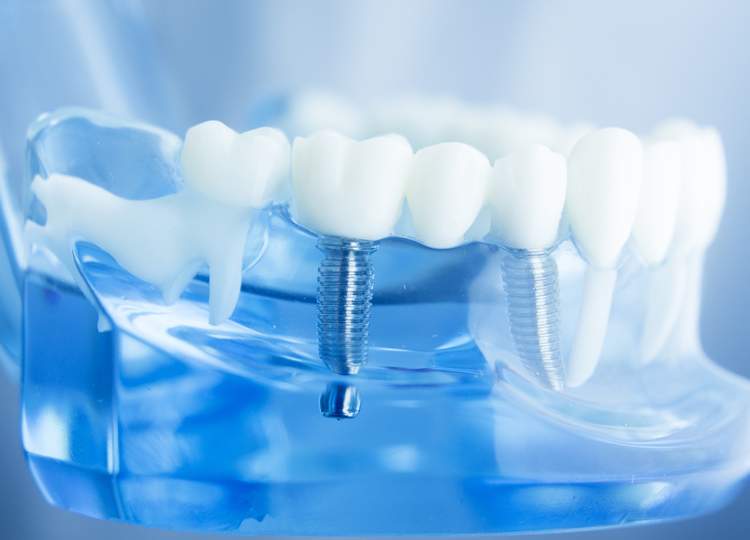 service-oral-surgery-image