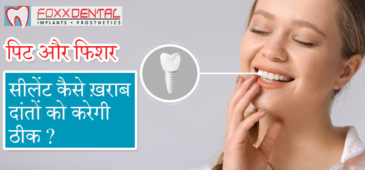 पिट-और-फिशर-सीलेंट-कैसे-ख़राब-दांतों-को-करेगी-ठीक