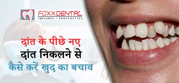 दांत के पीछे नए दांत निकलने से कैसे करें खुद का बचाव ?